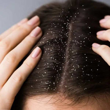 Dandruff & Scalp Care